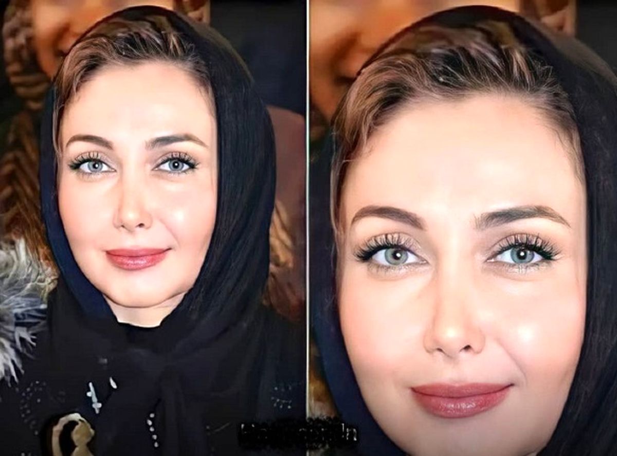 چهره وحشتناک کتایون ریاحی همه را میخکوب کرد | بیماری کتایون ریاحی علنی شد